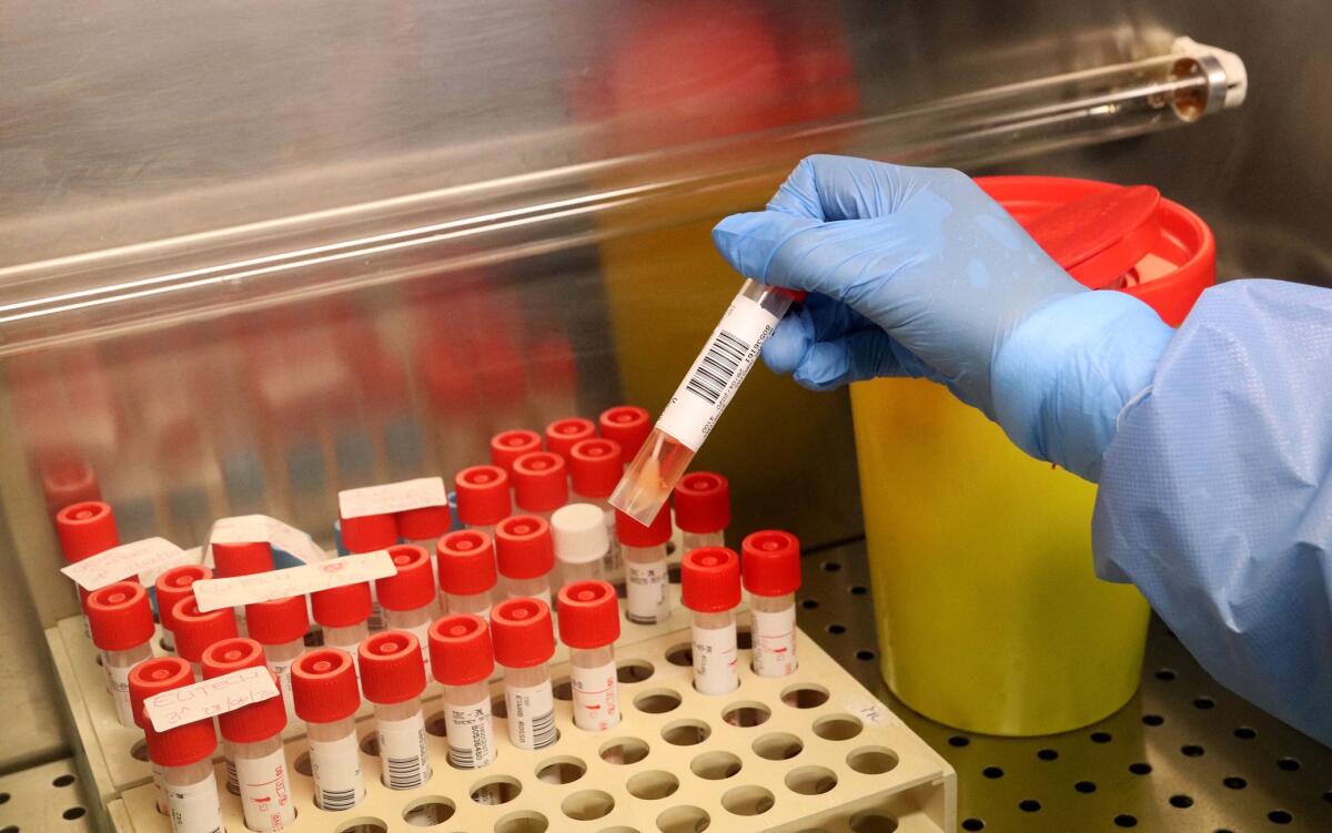 Gela, quattro positivi e 5 guariti al Covid - Medical biologists and laboratory technicians wearing protective gear working with swabs samples in a laboratory of Microbiology and Virology, where tests for SARS-CoV-2 which causes the COVID-19 disease are conducted for suspected cases.. on April 2