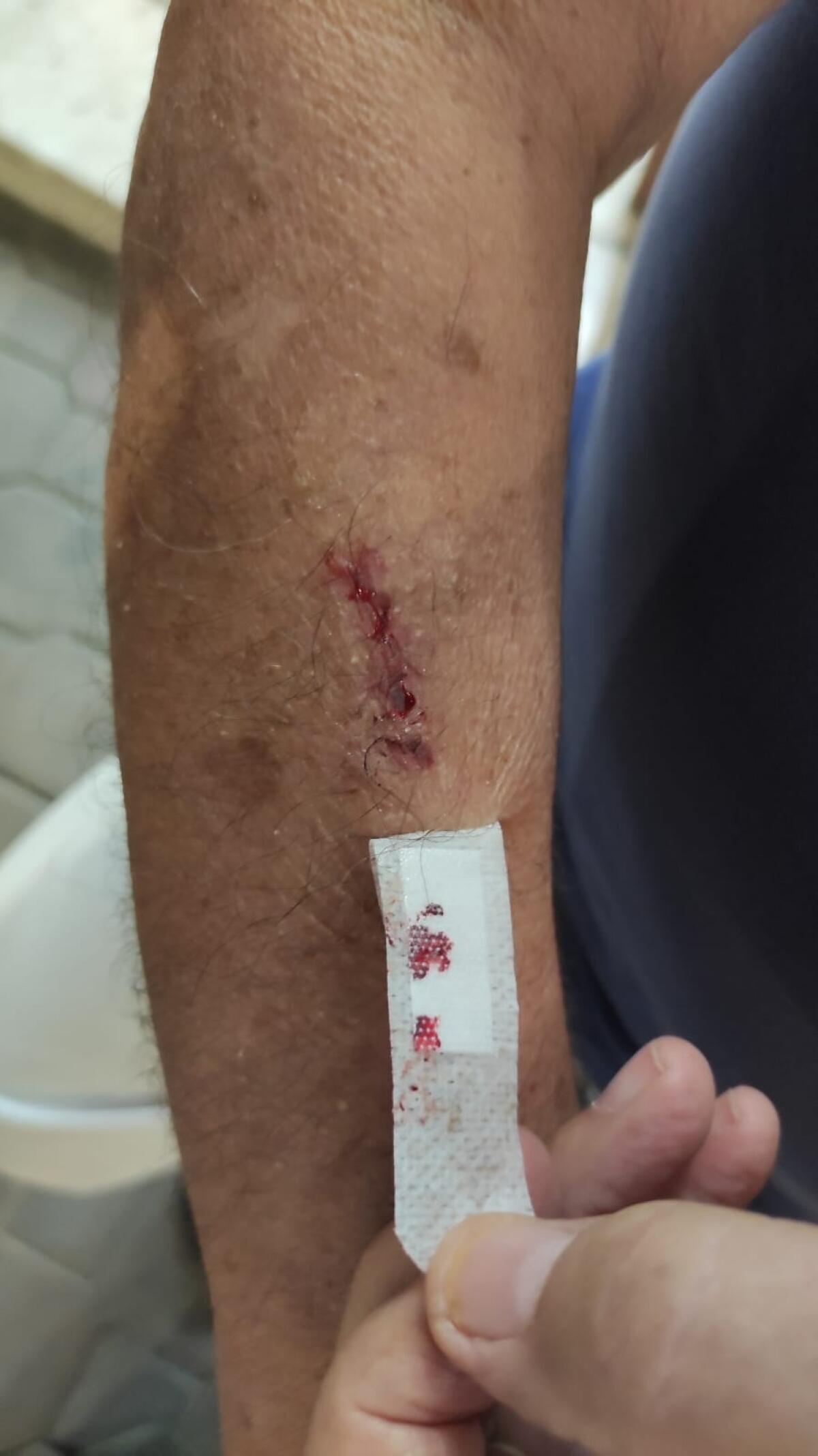 La Fipe: fioriere ok ma le piante sono pericolose - 